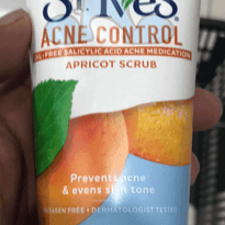 St. Ives Acne Control Apricot Scrub 170G Beauty